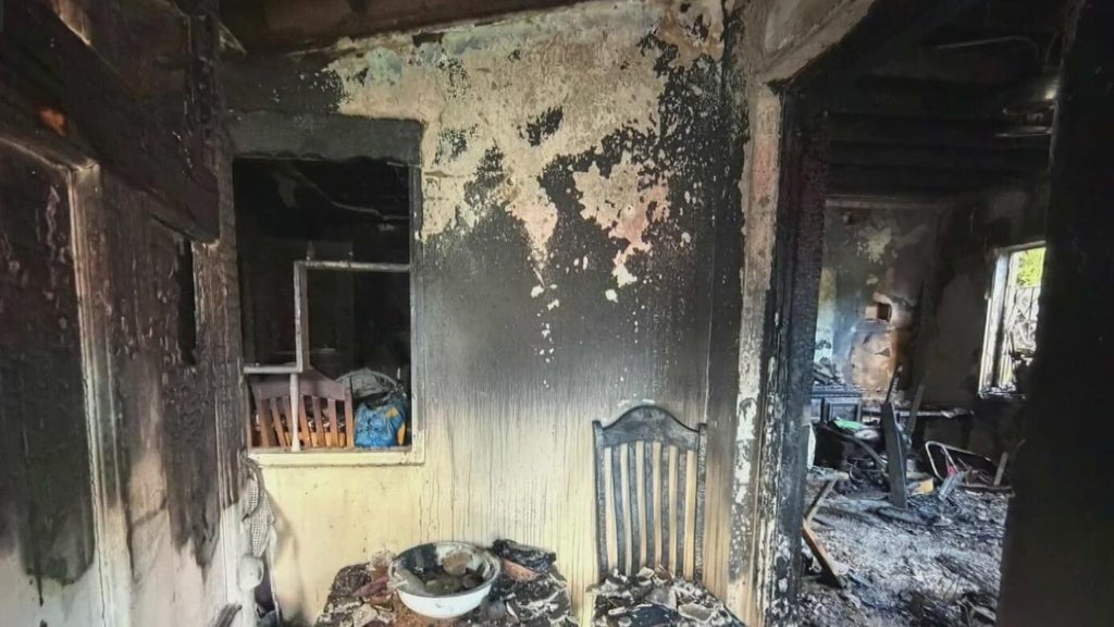 Woman hospitalized after Miami house fire leaves three displaced — CBS Miami, Arlington Health news